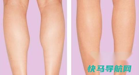 如何瘦小腿肌肉 第3张